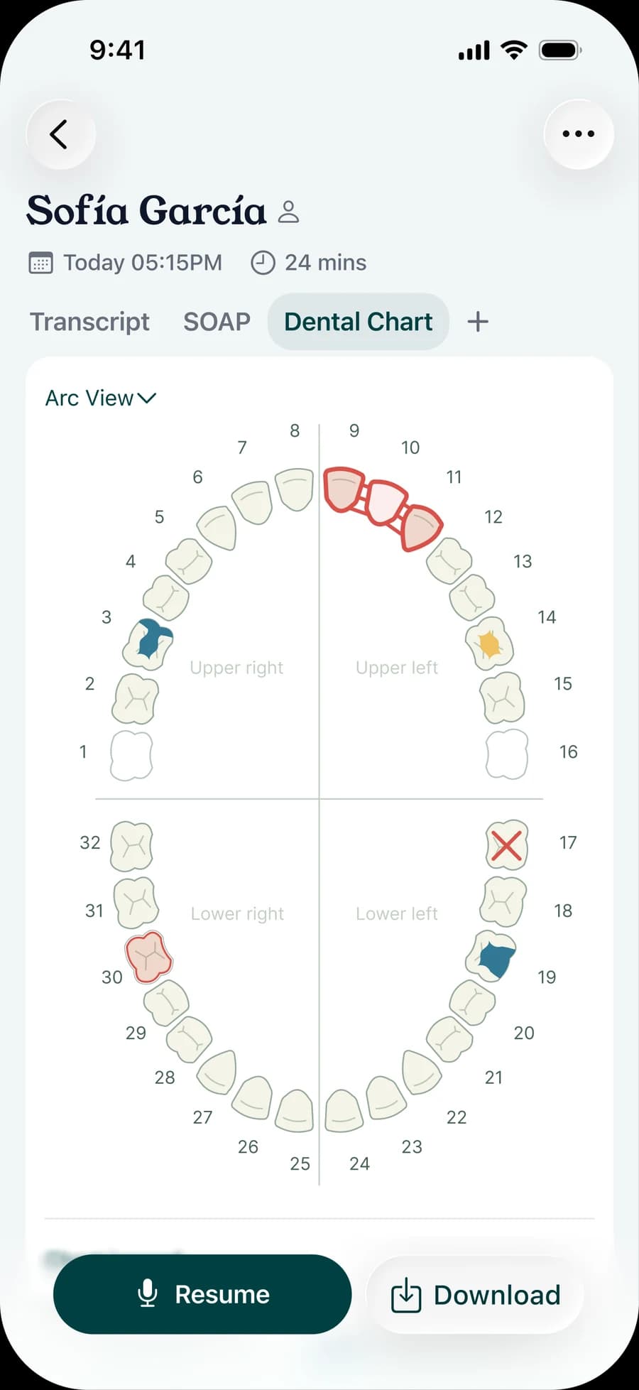 The Denti Note app showing a patient’s dental chart in arc view, with treatments and findings marked on the teeth.